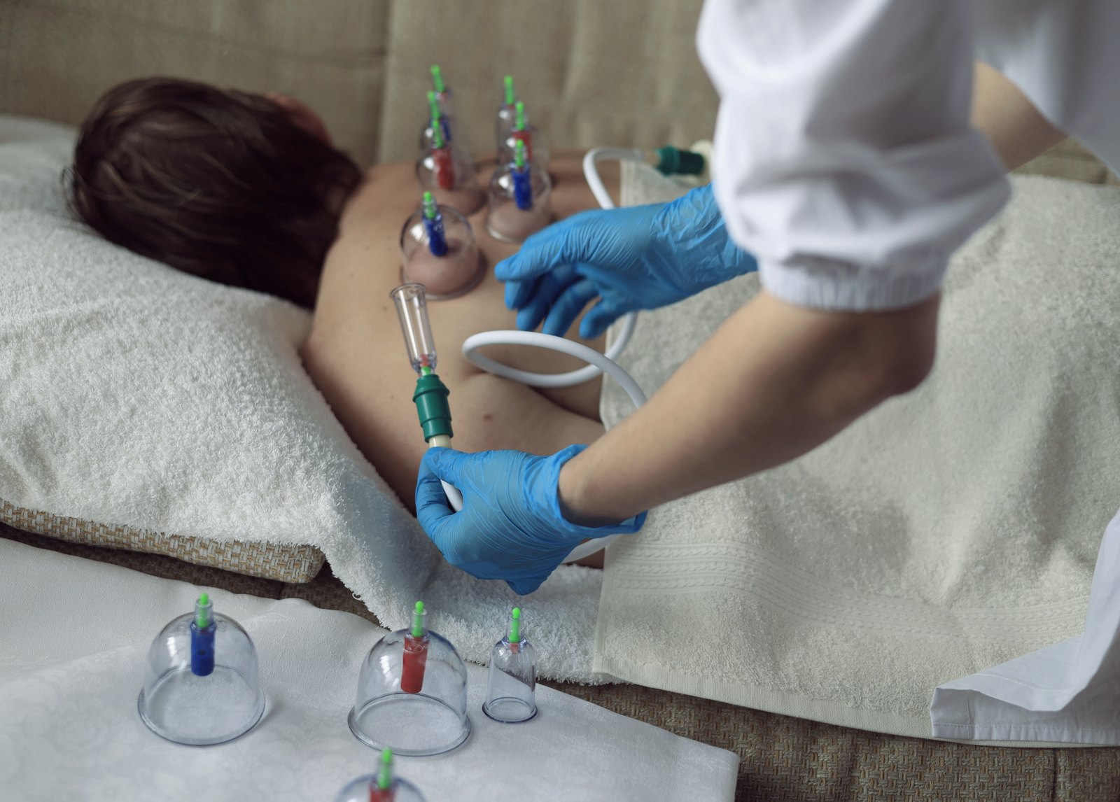 Cupping therapy session on a client's back